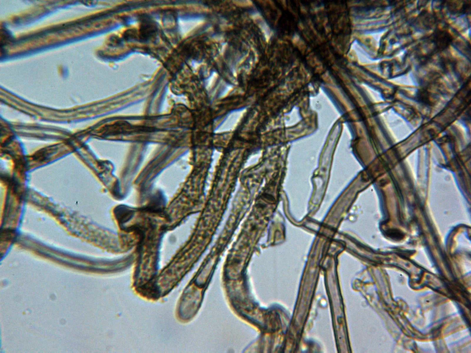 Microscopía de Tomentella lapida - 10 - Hifas Melzer 1